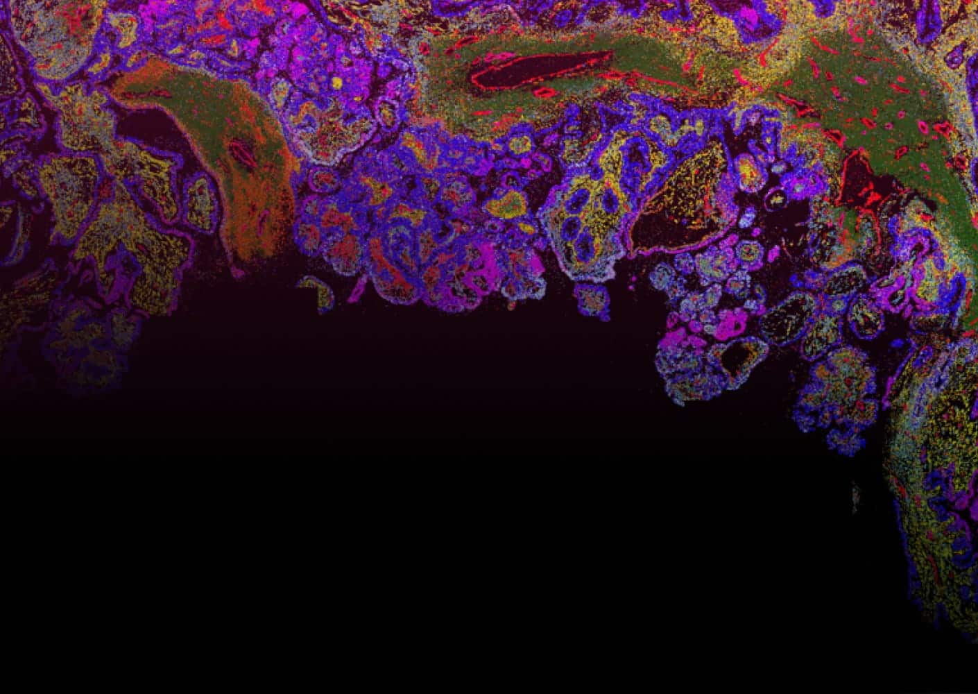 Spatial Transcriptomics