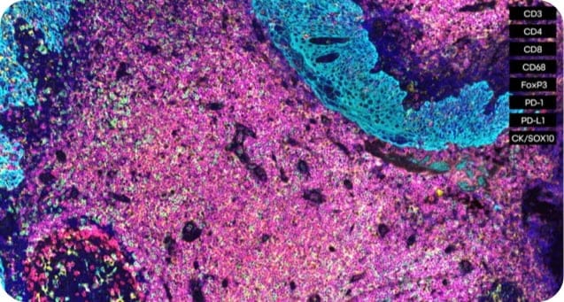 U-VUE Custom Biomarker Panels